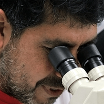 Chalky Teeth | Mission