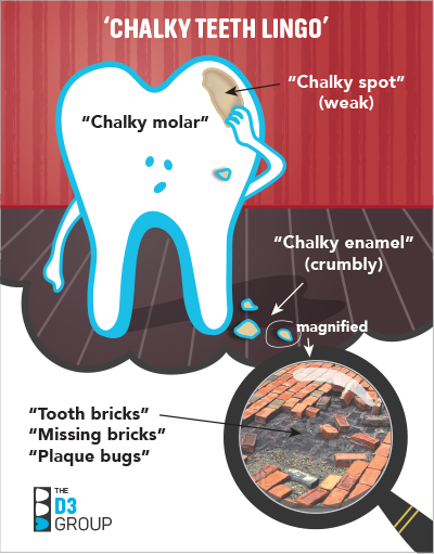 Chalky Teeth lingo pic