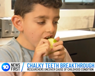 Chalky Teeth breakthrough media pic